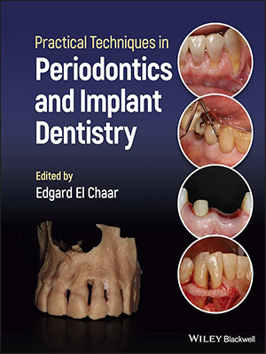 دانلود کتاب تکنیک های عملی در پریودنتیکس و ایمپلنت دندانپزشکی Practical Techniques in Periodontics and Implant Dentistry