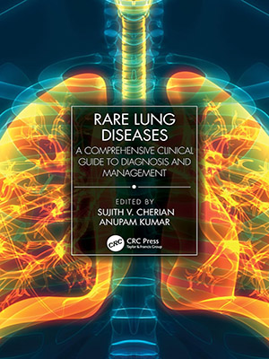 دانلود کتاب راهنمای بالینی جامع برای تشخیص و مدیریت بیماری های نادر ریه Rare Lung Diseases: A Comprehensive Clinical Guide to Diagnosis and Management