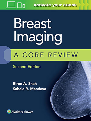 دانلود کتاب بررسی مراحل اصلی تصویربرداری از سینه 2017 Breast Imaging: A Core Review