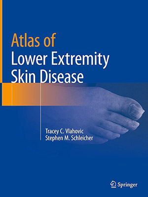 دانلود کتاب اطلس بیماری های پوستی اندام های تحتانی Atlas of Lower Extremity Skin Disease