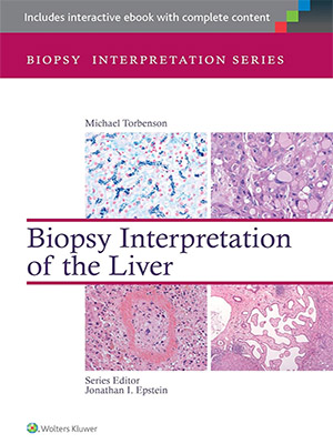 دانلود کتاب تفسیر بیوپسی از طریق کبد Biopsy Interpretation of the Liver