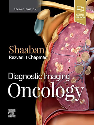 دانلود کتاب تصویربرداری تشخیصی: انکولوژی 2019 Diagnostic Imaging: Oncology
