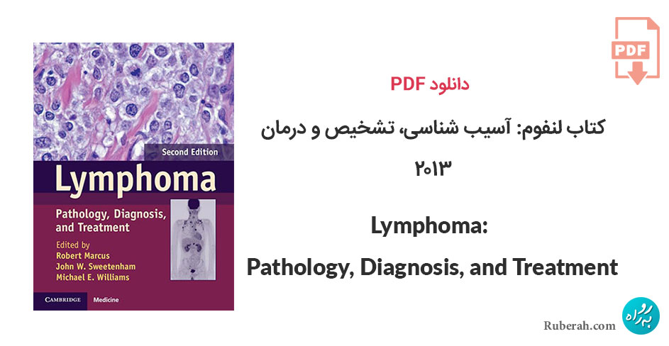 دانلود کتاب لنفوم: آسیب شناسی، تشخیص و درمان Lymphoma: Pathology, Diagnosis, and Treatment