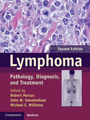 دانلود کتاب لنفوم: آسیب شناسی، تشخیص و درمان Lymphoma: Pathology, Diagnosis, and Treatment