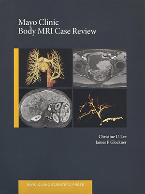 دانلود کتاب بررسی موارد ام آر ای (MRI) بدن Mayo Clinic Body MRI Case Review