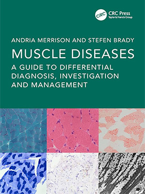 دانلود کتاب راهنمای تشخیص و مدیریت بیماری های عضلانی Muscle Diseases: A Guide to Differential Diagnosis, Investigation and Management