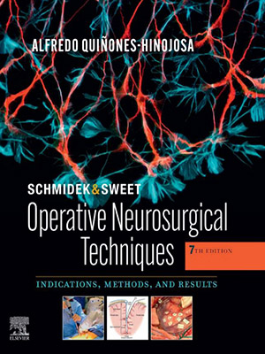 دانلود کتاب تکنیک های جراحی مغز و اعصاب Schmidek and Sweet: Operative Neurosurgical Techniques
