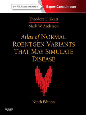 دانلود کتاب اطلس متغیرهای نرمال رونتگن جهت شبیه سازی بیماری Atlas of Normal Roentgen Variants That May Simulate Disease
