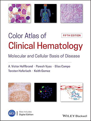 دانلود کتاب اطلس رنگی هماتولوژی بالینی Color Atlas of Clinical Hematology: Molecular and Cellular Basis of Disease
