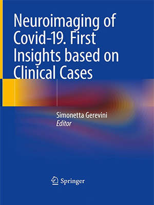 دانلود کتاب تصویربرداری عصبی از کووید-19. اولین بینش بر اساس موارد بالینی Neuroimaging of Covid-19. First Insights based on Clinical Cases