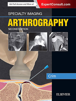 دانلود کتاب تصویربرداری تخصصی: آرتروگرافی Specialty Imaging: Arthrography