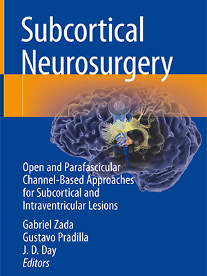 دانلود کتاب جراحی مغز و اعصاب زیر قشری 2022 Subcortical Neurosurgery