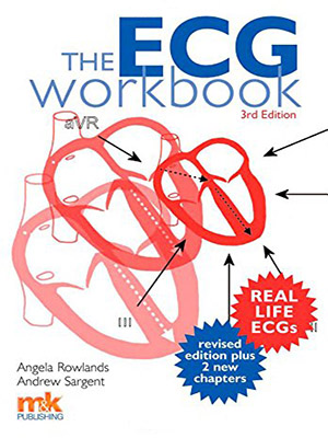 دانلود کتاب کار ECG (تست نوار قلب یا الکتروکاردیوگرام) The ECG Workbook