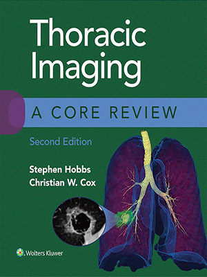 دانلود کتاب تصویربرداری قفسه سینه 2020 Thoracic Imaging: A Core Review