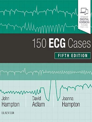 دانلود کتاب 150 مورد ECG نسخه پنجم 2019 150ECG Cases