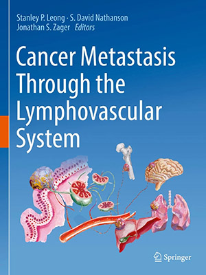 دانلود کتاب متاستاز سرطان از طریق سیستم لنفاوی عروقی Cancer Metastasis Through the Lymphovascular System