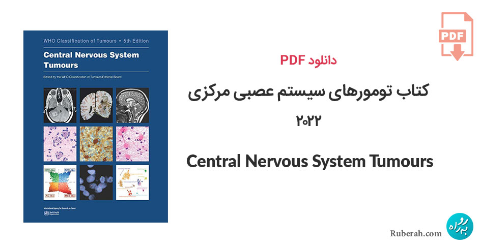 دانلود کتاب تومورهای سیستم عصبی مرکزی Central Nervous System Tumours