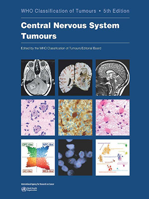 دانلود کتاب تومورهای سیستم عصبی مرکزی Central Nervous System Tumours
