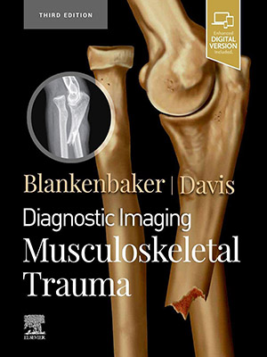 دانلود کتاب تصویربرداری تشخیصی: ترومای اسکلتی-عضلانی Diagnostic Imaging: Musculoskeletal Trauma