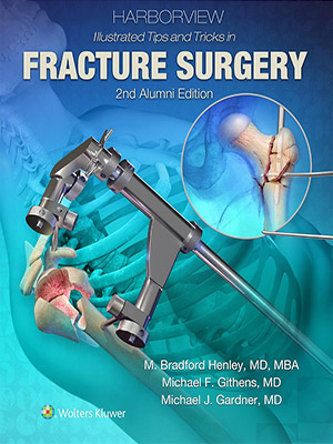دانلود کتاب نکات و ترفندهای مصور در جراحی شکستگی Harborview Illustrated Tips and Tricks in Fracture Surgery