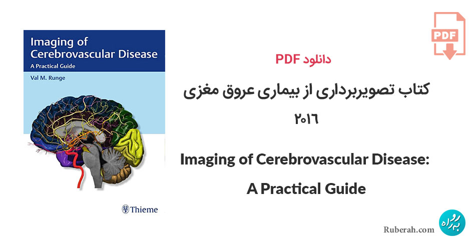 دانلود کتاب تصویربرداری از بیماری عروق مغزی Imaging of Cerebrovascular Disease: A Practical Guide
