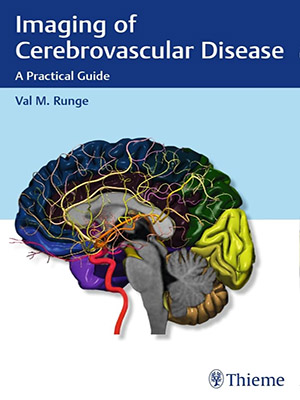 دانلود کتاب تصویربرداری از بیماری عروق مغزی Imaging of Cerebrovascular Disease: A Practical Guide
