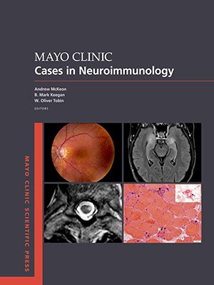 دانلود کتاب موارد نوروایمونولوژی کلینیک مایو Mayo Clinic Cases in Neuroimmunology