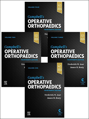 دانلود کتاب ارتوپدی عملی کمپبل، مجموعه ۴ جلدی Campbell's Operative Orthopaedics, 4-Volume Set