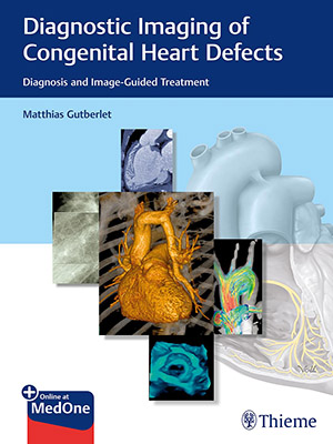 دانلود کتاب تصویربرداری تشخیصی نقصهای مادرزادی قلب Diagnostic Imaging of Congenital Heart Defects: Diagnosis and Image-Guided Treatment