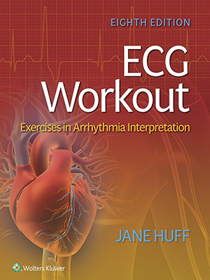 دانلود کتاب تمرین نوار قلب: تفسیر آریتمی قلب ECG Workout: Exercises in Arrhythmia Interpretation