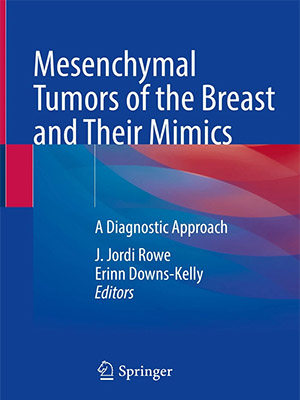 دانلود کتاب تومورهای مزانشیمی پستان و تومورهای مقلد آنها Mesenchymal Tumors of the Breast and Their Mimics: A Diagnostic Approach