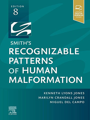 دانلود کتاب الگوهای قابل تشخیص ناهنجاری‌های انسانی Smith's Recognizable Patterns of Human Malformation