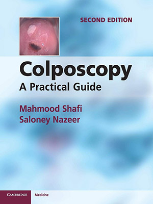 دانلود کتاب کولپوسکوپی: یک راهنمای عملی Colposcopy: A Practical Guide
