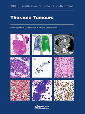دانلود کتاب طبقه بندی تومورهای قفسه سینه Thoracic Tumours: WHO Classification of Tumours