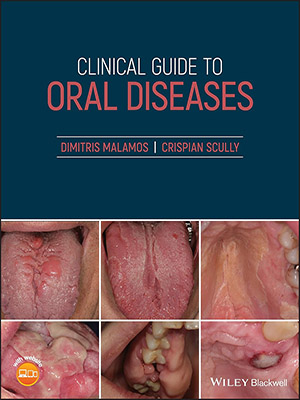 دانلود کتاب راهنمای بالینی بیماری های دهان Clinical Guide to Oral Diseases
