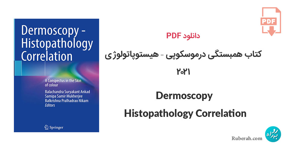 دانلود کتاب همبستگی درموسکوپی - هیستوپاتولوژی Dermoscopy - Histopathology Correlation: A Conspectus in the Skin of colour