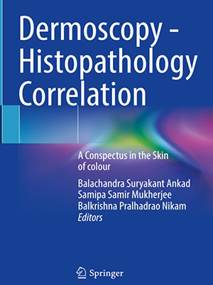 دانلود کتاب همبستگی درموسکوپی - هیستوپاتولوژی Dermoscopy - Histopathology Correlation: A Conspectus in the Skin of colour