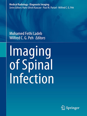 دانلود کتاب تصویربرداری از عفونت ستون فقرات 2021 Imaging of Spinal Infection