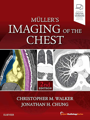 دانلود کتاب تصویربرداری از قفسه سینه مولر Muller's Imaging of the Chest