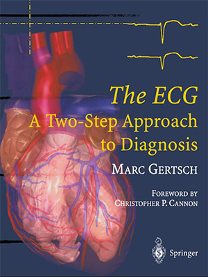 دانلود کتاب ECG: رویکردی دو مرحلهای برای تشخیص The ECG: A Two-Step Approach to Diagnosis