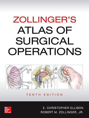 دانلود کتاب اطلس عمل های جراحی زولینگر Zollinger's Atlas of Surgical Operations