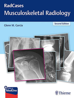 دانلود کتاب پرسش و پاسخ رادیولوژی اسکلتی عضلانی رادکِیس RadCases Q&A Musculoskeletal Radiology