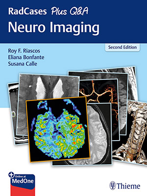 دانلود کتاب پرسش و پاسخ تصویربرداری عصبی رادکِیس RadCases Plus Q&A Neuro Imaging