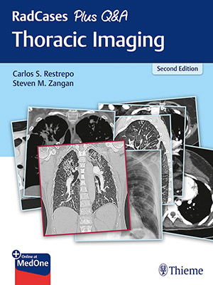 دانلود کتاب پرسش و پاسخ تصویربرداری قفسه سینه رادکِیس RadCases Plus Q&A Thoracic Imaging