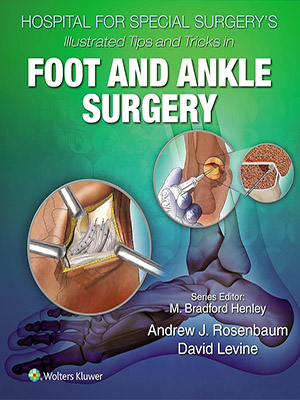 دانلود کتاب نکات و ترفندهای مصور در جراحی پا و مچ پا Hospital for Special Surgery's Illustrated Tips and Tricks in Foot and Ankle Surgery