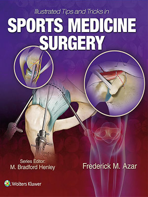 دانلود کتاب نکات و ترفندهای مصور در جراحی پزشکی ورزشی Illustrated Tips and Tricks in Sports Medicine Surgery