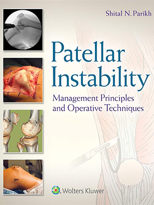 دانلود کتاب بیثباتی کشکک زانو: اصول مدیریت و تکنیکهای عملی Patellar Instability: Management Principles and Operative Techniques