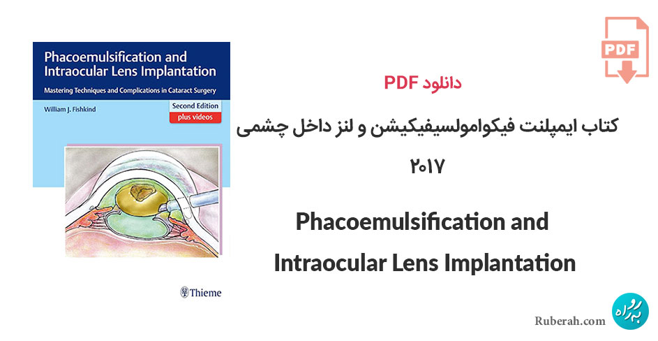 دانلود کتاب ایمپلنت فیکوامولسیفیکیشن و لنز داخل چشمی Phacoemulsification and Intraocular Lens Implantation: Mastering Techniques and Complications in Cataract Surgery