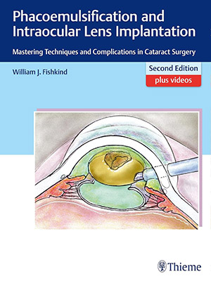 دانلود کتاب ایمپلنت فیکوامولسیفیکیشن و لنز داخل چشمی Phacoemulsification and Intraocular Lens Implantation: Mastering Techniques and Complications in Cataract Surgery