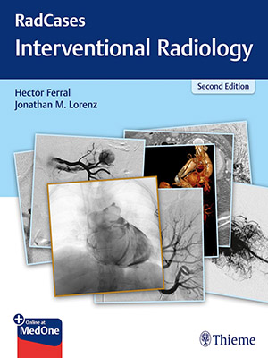 دانلود کتاب پرسش و پاسخ رادیولوژی مداخله ای رادکِیس RadCases Q&A Interventional Radiology